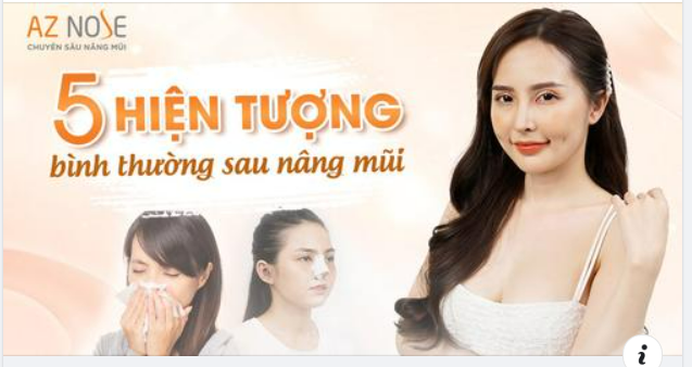 5 hiện tượng sau nâng mũi không lạ như bạn nghĩ