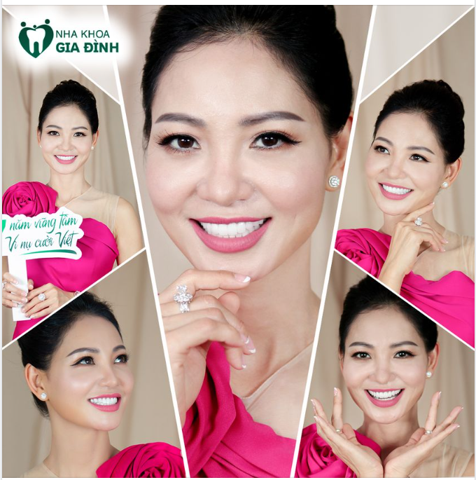 Á HOÀNG KIM CƯƠNG LƯU LAN ANH NGÀY CÀNG THĂNG HẠNG NHAN SẮC