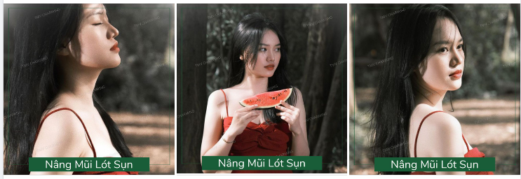 Ai bảo nâng mũi lót sụn thì không sắc sảo, không tôn được đường nét của chiếc mũi thì feedback này sẽ khiến bạn phải suy nghĩ lại đấy