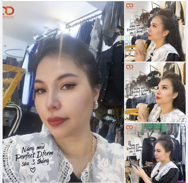 Album Feedback khách hàng là tập hợp các hình ảnh khách hàng đã thực hiện dịch vụ tại DrD.