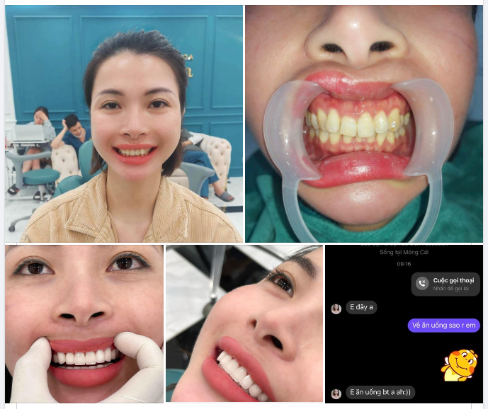 Bác sĩ Dũng - "Phù thủy của những nụ cười" chuyên giải cứu các tình trạng răng khó và siêu khó của khách hàng.