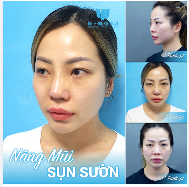 Bản chất chúng ta đều thích tự do, nên khi dừng chân thì nhất định phải thật xứng đáng.