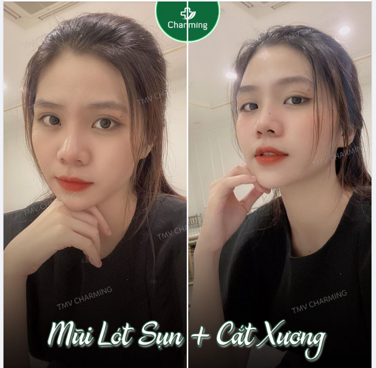 Bạn xem hình feedback của Charming nhiều thì hẳn đã có kinh nghiệm rồi đúng không nào ​​​​​​​