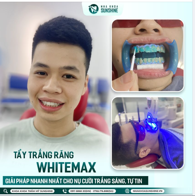 Bật mí lí do nên  Tẩy trắng răng tại  Sunshine