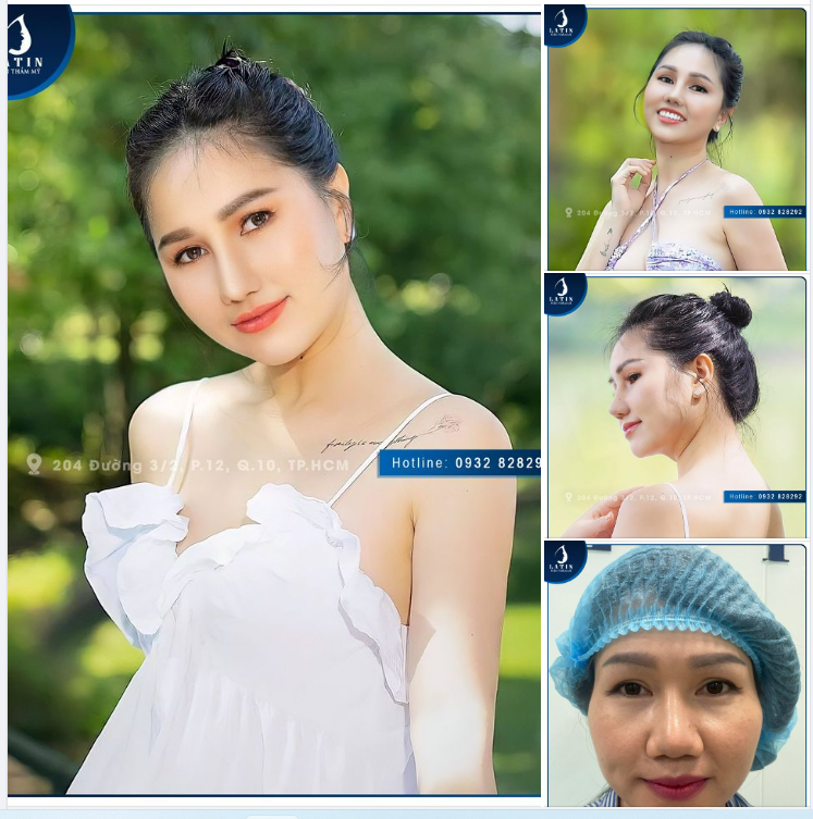 Bay nửa vòng trái đất về Việt Nam làm đẹp có xứng đáng