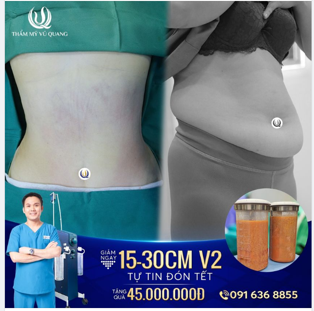 Béo là xấu - 1 điều không thể phủ nhận!