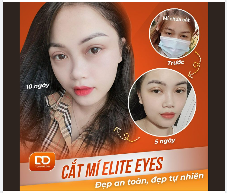 BÍ QUYẾT ĐỂ CÓ ĐÔI MẮT 2 MÍ ĐẸP LONG LANH