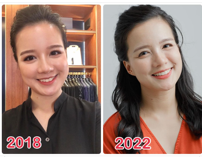 BỨC ẢNH KHIẾN CHÚNG TA PHẢI ĐI NIỀNG RĂNG NGAY THÔI