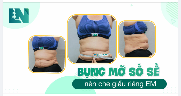 BỤNG MỠ SỒ SỀ NÊN CHE GIẤU RIÊNG EM!