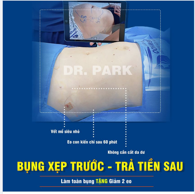 BỤNG XẸP TRƯỚC - TRẢ TIỀN SAU - LÀM ĐẸP KHÔNG LO CHI PHÍ