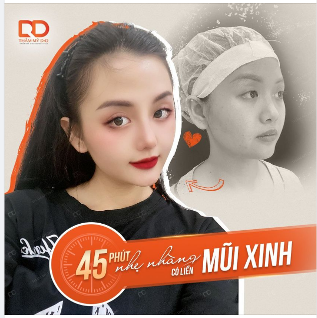 CAN THIỆP NHẸ NHÀNG - CÓ LIỀN MŨI XINH
