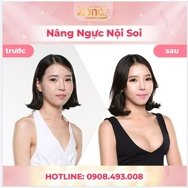 CĂNG TRÒN - MỀM MẠI - TỰ NHIÊN = Kết quả 3 trong 1 chỉ sau 1 lần đổi mới vòng 1 cùng bác sĩ Vương Khánh Long.