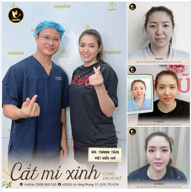CẮT MÍ XINH CÙNG DR. HOẠT