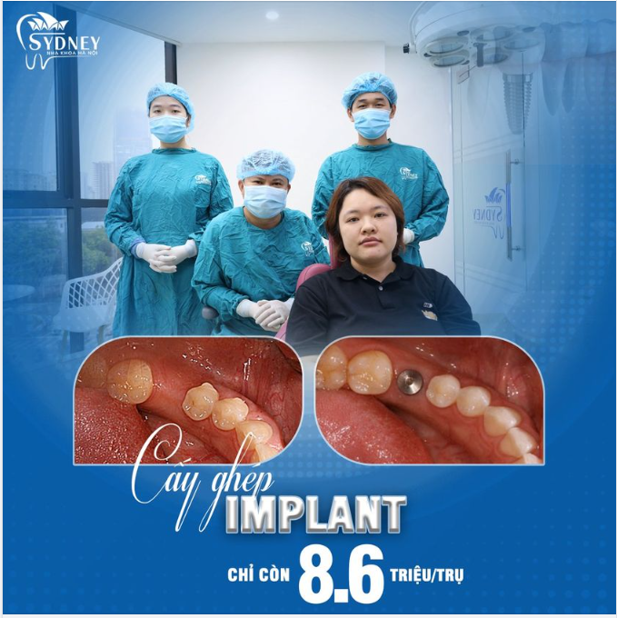 Cấy ghép Implant – sự lựa chọn hàng đầu cho người mất răng
