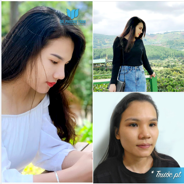 Chào đầu tuần rực rỡ bằng một chiếc feedback nâng mũi sụn sườn vô cùng đáng yêu. Chúc cả nhà tuần mới vui vẻ.