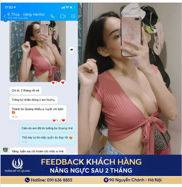 Chào ngày mới bằng chiếc Feedback V1 siêu xinh