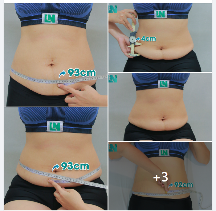 CHỊ KH 35 TUỔI – SỞ HỮU CHIỀU CAO LÝ TƯỞNG 1M79 NHƯNG VÓC DÁNG KHÔNG ĐƯỜNG EO. 