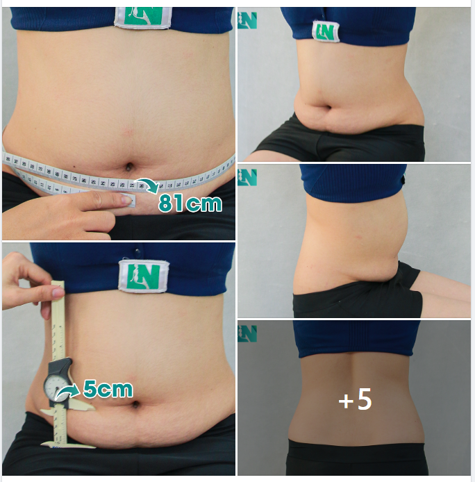 CHỊ KH 9X – LÀM VIỆC TRONG LĨNH VỰC THỜI TRANG: MONG MUỐN DÁNG ĐẸP ĐÚNG CHUẨN