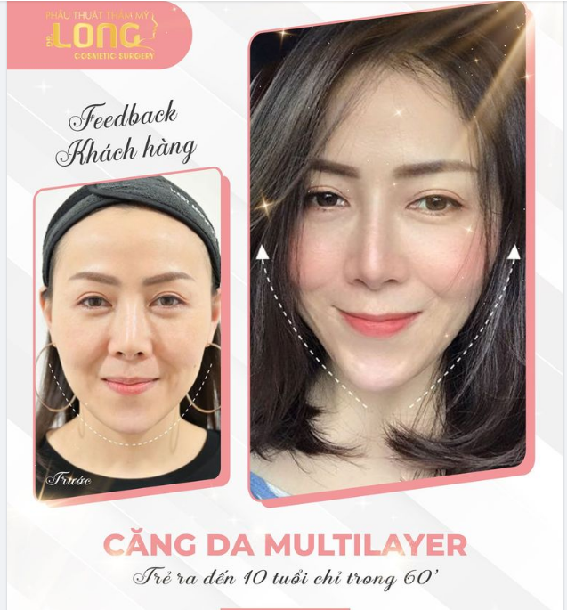CHI PHÍ LÊN ĐẾN CON SỐ KHỦNG MỖI NĂM CHỈ VÌ 1 LÀN DA ĐẸP TRẺ KHỎE QUÁ TỐN KÉM PHẢI LÀM SAO TIẾT KIỆM MÀ VẪN CÓ THỂ TRẺ ĐẸP
