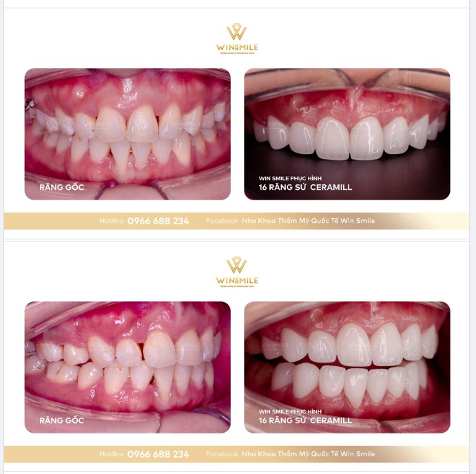 CHỈ VÌ CHÚT LẦM LỠ MÀ CÔNG SỨC 3 NĂM BAY THEO MÂY TRỜI