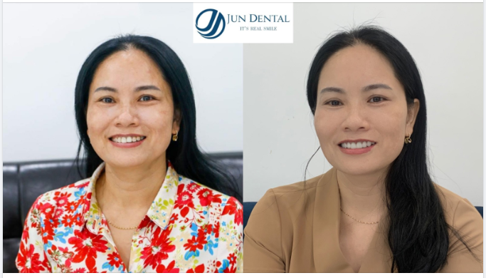 CHỌN THAY ĐỔI, LỰA CHỌN SỨ CAO CẤP HT SMILE