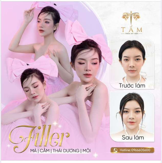 Chưa làm cằm ngắn, má cao - làm xong nét đẹp ước ao bao người