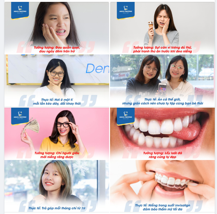 Chưa niềng lo gió lo mây Niềng rồi mới biết chẳng mảy may giống lời đồn
