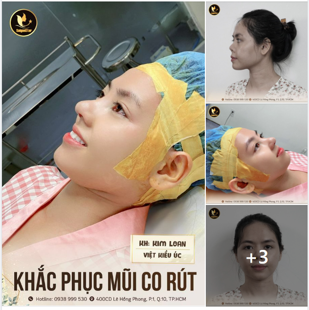 Chúc mừng chị Kim Loan với diện mạo mới xinh đẹp hơn của mình