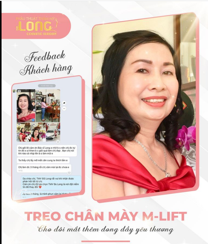 Cô Khách quá đỗi dễ thương gửi hình ảnh hiện tại sau lần thực hiện Treo chân mày Mlift