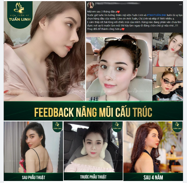 Cô nàng T. T đã tin tưởng lựa chọn Tuấn Linh để gửi gắm chiếc mũi của mình. Tuấn Linh đã không làm bạn ấy thất vọng.