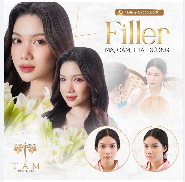 Combo Filler - Liệu pháp làm đẹp dành cho những khách hàng bận rộn