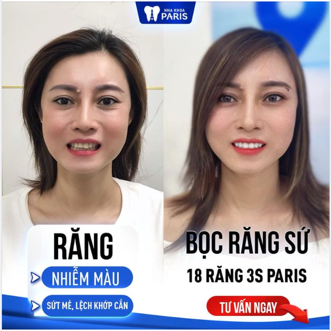 CÔNG NGHỆ ĐỘC QUYỀN TỪ PHÁP