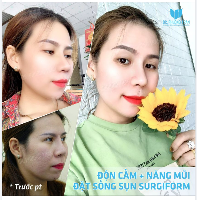 Cứ cố gắng đẹp hết khả năng thì tự khắc tỏa sáng cả nhà nhé!