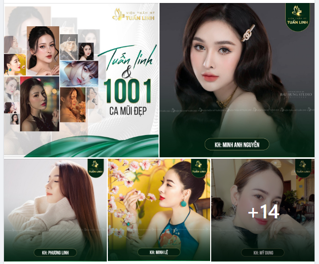 Cùng chiêm ngưỡng những case mũi đẹp được tạo nên bởi đôi bàn tay chuyên môn điêu luyện của bác sĩ nhà chúng mình để lấy động lực làm đẹp nha!