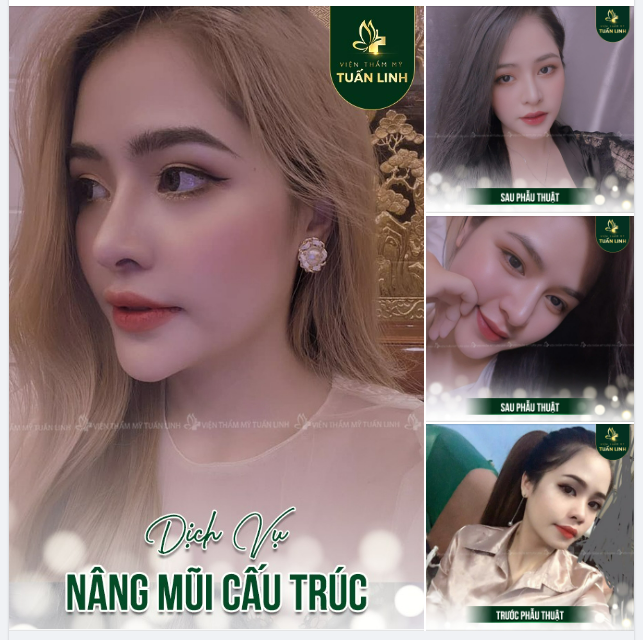 Dáng mũi cao tây cho gương mặt cá tính