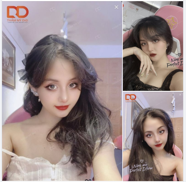 Dáng mũi Perfect Dform 1 tháng tuổi