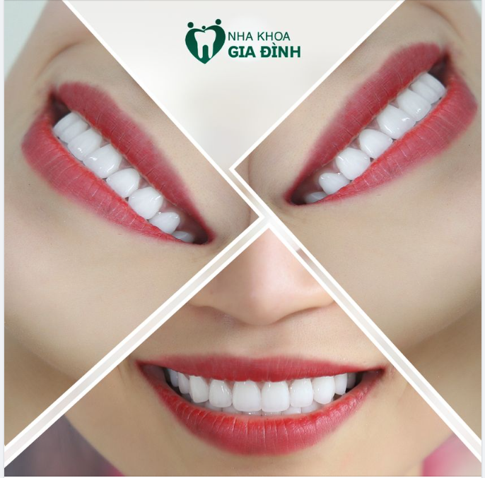 ĐÁNH THỨC NỤ CƯỜI XINH - TẠO HÌNH CUỘC SỐNG MỚI