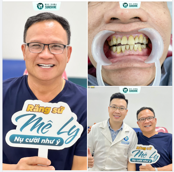 ĐÂU PHẢI CHỈ NGƯỜI TRẺ MỚI LÀM RĂNG