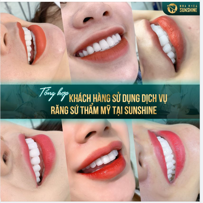 Để có được một nụ cười tỷ lệ hài hoà với khuôn mặt, một hàm răng trắng sáng, đều đẹp và chắc khoẻ