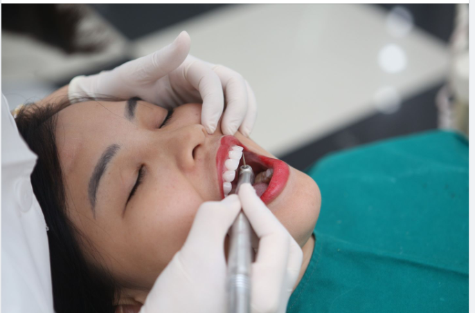 ​​​​​​​Đến Nha khoa Gia Đình, các bước thẩm mỹ răng luôn được bác sĩ làm một cách cẩn thận và chuẩn chỉnh.