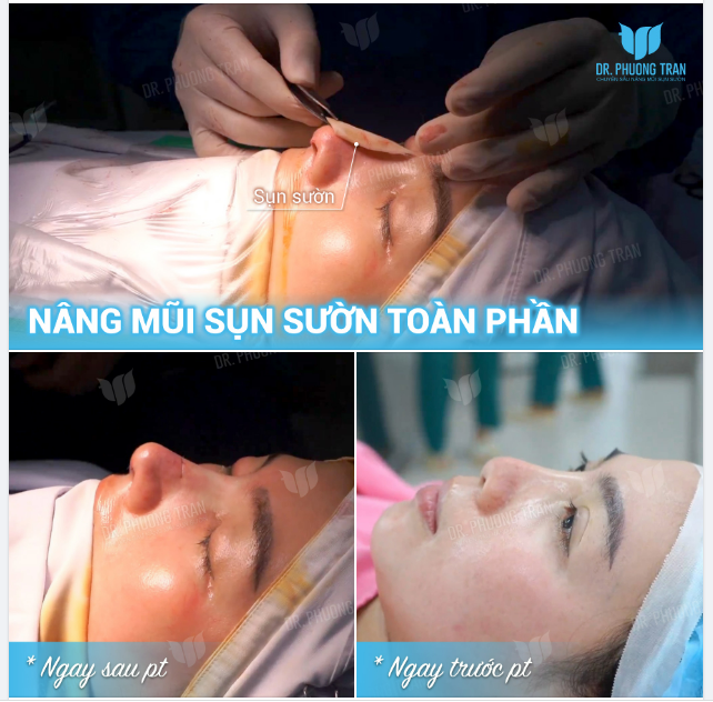 ĐẸP HAY RẤT ĐẸP CẢ NHÀ ƠI