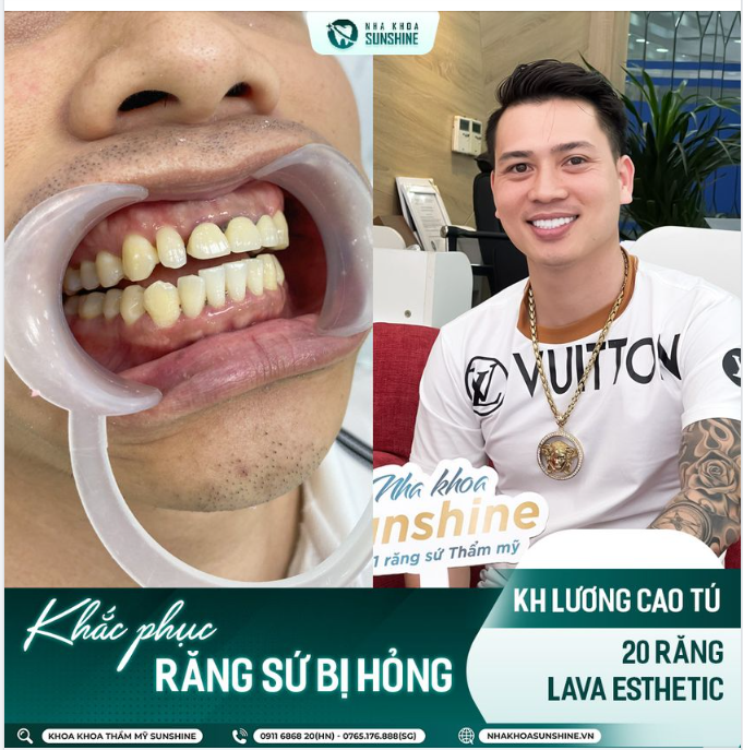 ĐẸP TỪ BÊN NGOÀI - CHẮC KHỎE TỪ BÊN TRONG