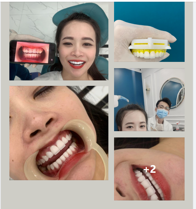 Điều gì đã khiến khách hàng tin tưởng lựa chọn làm răng sứ tại Delia?