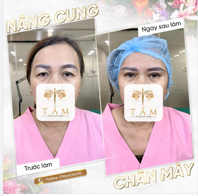 Đôi mắt là cửa sổ tâm hồn. Bao nhiêu tâm tư, cảm xúc đều nhìn qua đôi mắt.