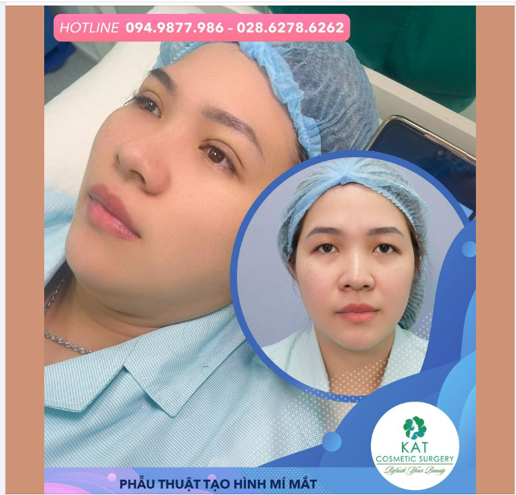 Đôi mắt long lanh chỉ sau 15 phút