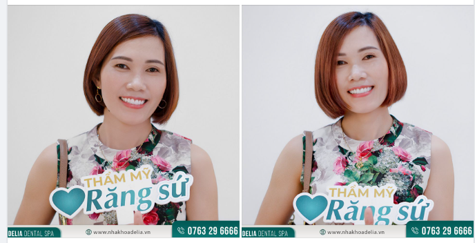 Đối với chị, đầu tư cho nụ cười không chỉ giúp mình tỏa sáng mà còn là khởi đầu của mọi may mắn trong cuộc sống.
