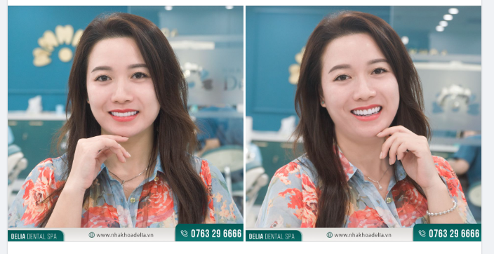 "Đối với mình, một nụ cười rạng rỡ giống như vũ khí vô hình mang lại sự tự tin để sẵn sàng đón nhận may mắn và thành công.