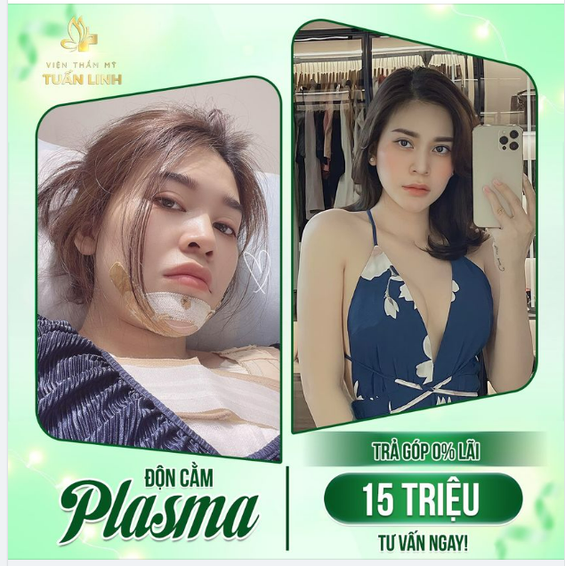 ĐỘN CẰM VLINE 15TR - TRẢ GÓP 0% LÃI