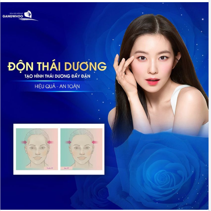 ĐỘN THÁI DƯƠNG - TẠO HÌNH THÁI DƯƠNG ĐẦY ĐẶN HIỆU QUẢ, AN TOÀN