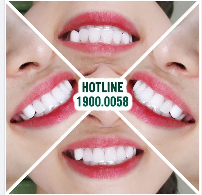 ĐỦ TRONG, ĐỦ BÓNG, ĐỦ ĐẸP ĐỂ KHÁCH YÊU ĐẾN VỚI NHA KHOA GIA ĐÌNH CHƯA???